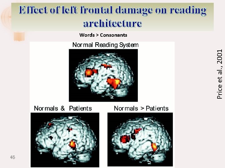 Effect of left frontal damage on reading architecture Price et al. , 2001 Words