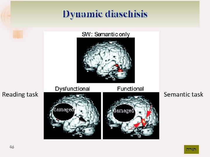 Dynamic diaschisis Reading task 46 Semantic task חזרה 