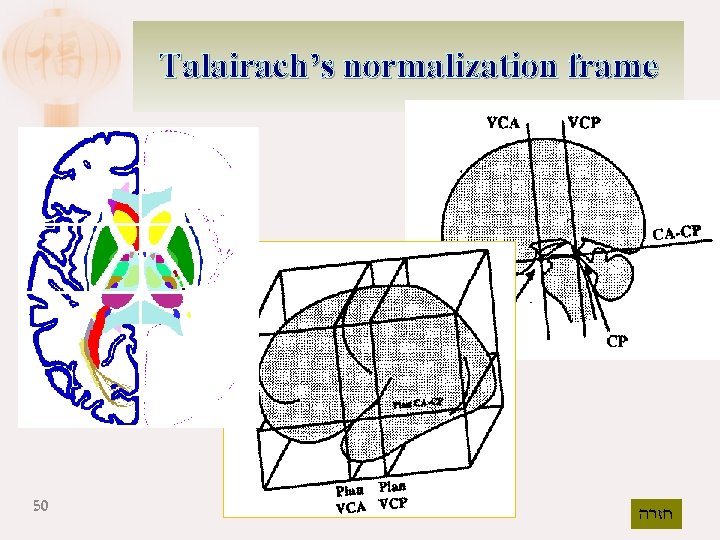 Talairach’s normalization frame 50 חזרה 
