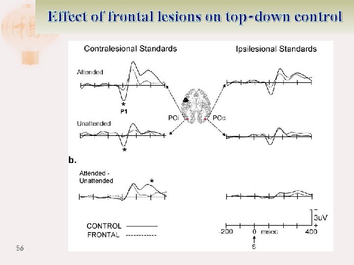 Effect of frontal lesions on top-down control 56 
