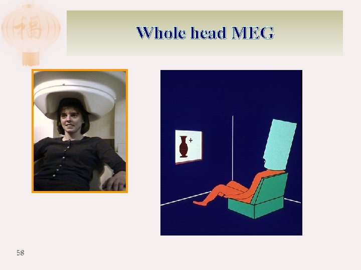 Whole head MEG 58 