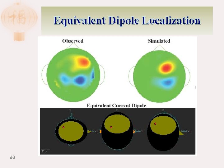 Equivalent Dipole Localization 63 