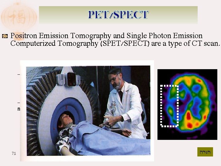 PET/SPECT Positron Emission Tomography and Single Photon Emission Computerized Tomography (SPET/SPECT) are a type