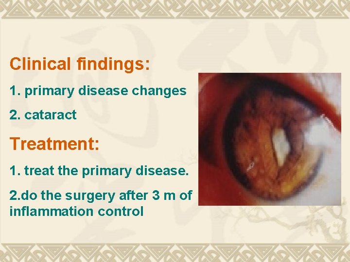Clinical findings: 1. primary disease changes 2. cataract Treatment: 1. treat the primary disease. Clinical findings: 1. primary disease changes 2. cataract Treatment: 1. treat the primary disease.