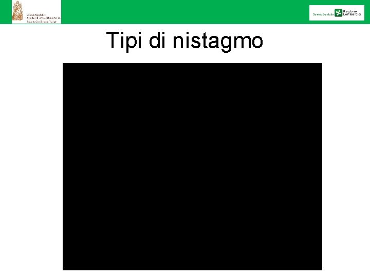 Tipi di nistagmo 