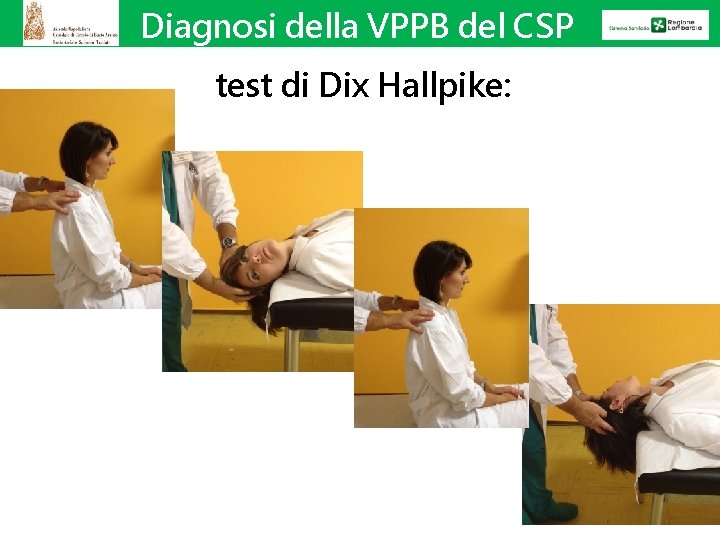 Diagnosi della VPPB del CSP test di Dix Hallpike: 