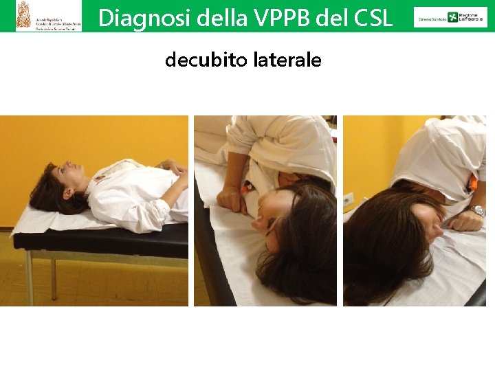 Diagnosi della VPPB del CSL decubito laterale 