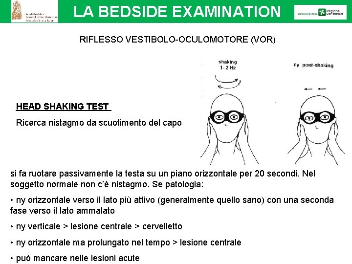 LA BEDSIDE EXAMINATION RIFLESSO VESTIBOLO-OCULOMOTORE (VOR) HEAD SHAKING TEST Ricerca nistagmo da scuotimento del