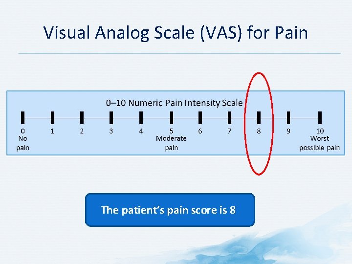 Visual Analog Scale (VAS) for Pain The patient’s pain score is 8 