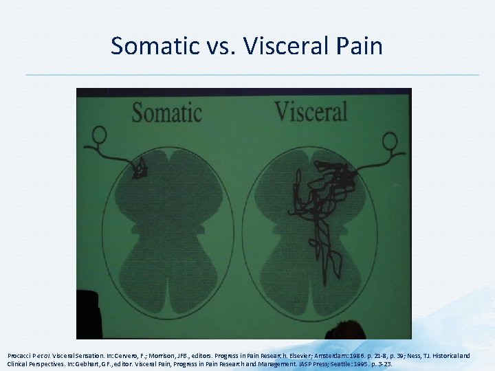 Somatic vs. Visceral Pain Procacci P et al. Visceral Sensation. In: Cervero, F. ;
