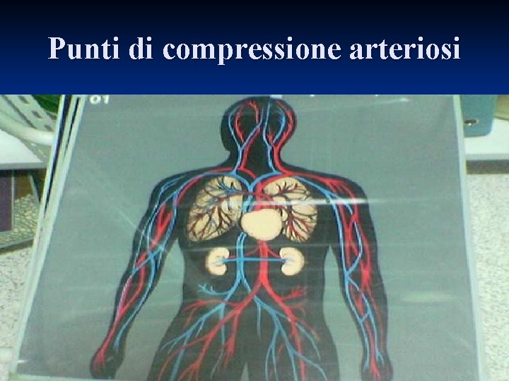 Punti di compressione arteriosi 