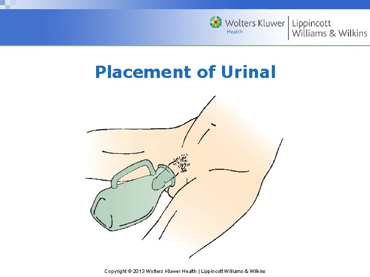 Placement of Urinal Copyright © 2013 Wolters Kluwer Health | Lippincott Williams & Wilkins