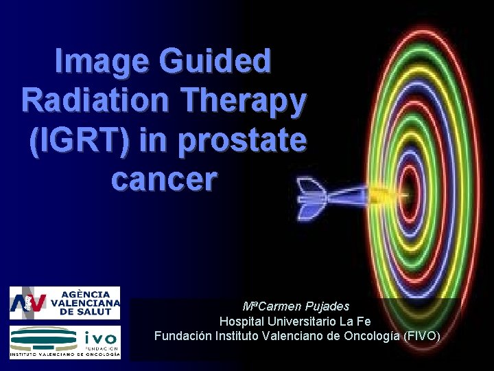 Image Guided Radiation Therapy (IGRT) in prostate cancer MªCarmen Pujades Hospital Universitario La Fe