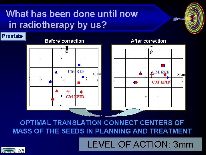 What has been done until now in radiotherapy by us? Prostate Before correction After