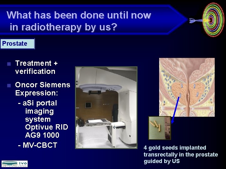What has been done until now in radiotherapy by us? Prostate ■ Treatment +