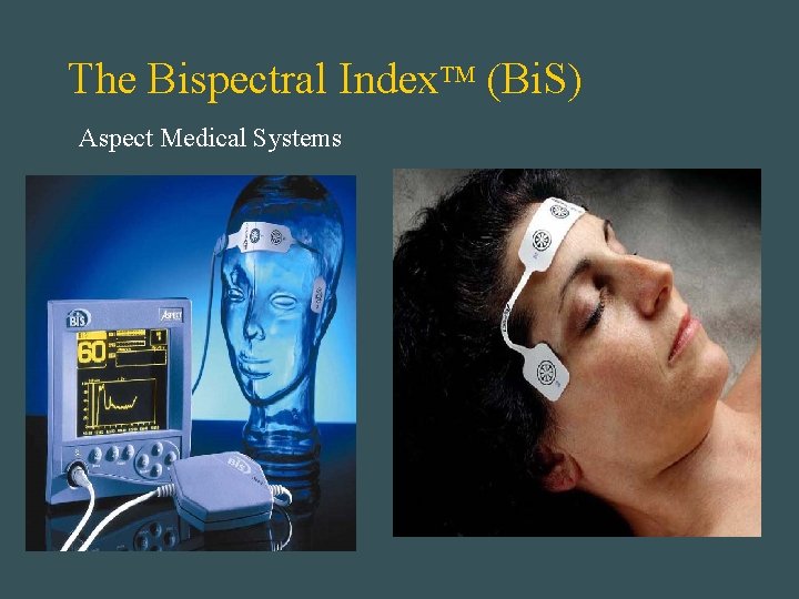 The Bispectral Index. TM (Bi. S) Aspect Medical Systems 