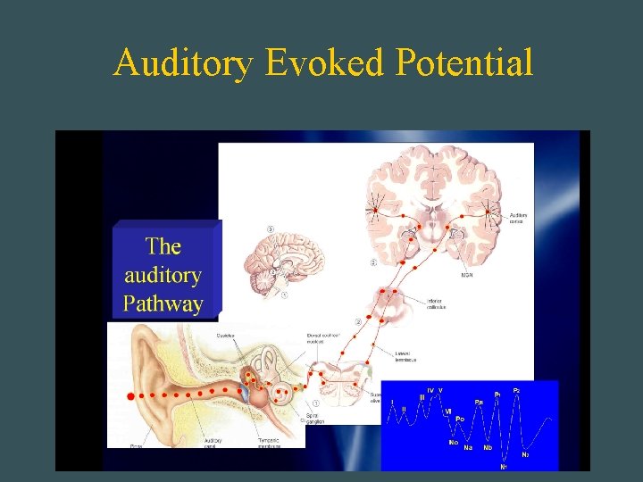 Auditory Evoked Potential 