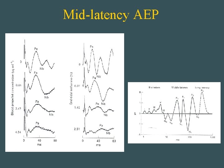 Mid-latency AEP 
