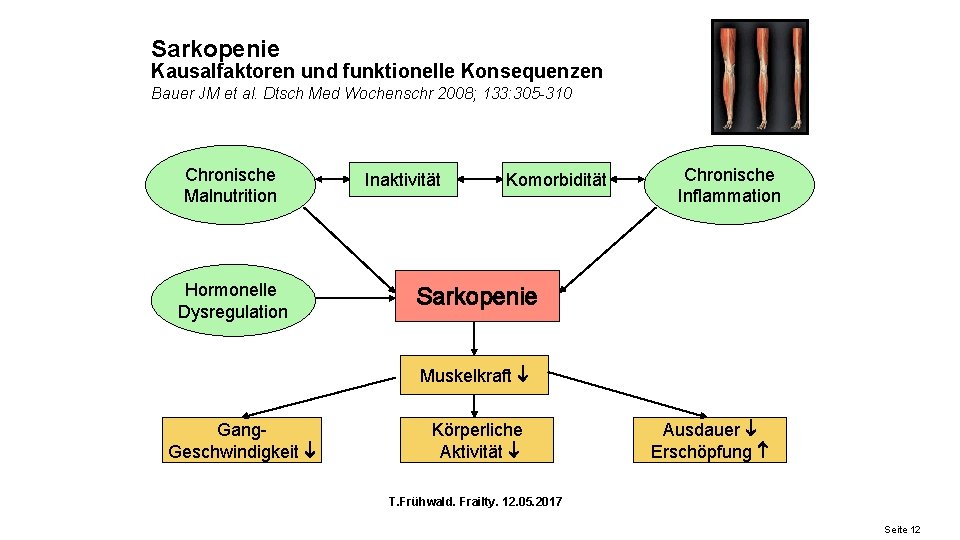Sarkopenie Kausalfaktoren und funktionelle Konsequenzen Bauer JM et al. Dtsch Med Wochenschr 2008; 133: