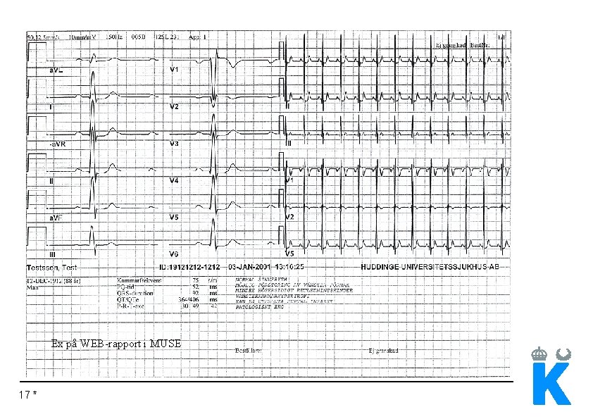 Ex på WEB-rapport i MUSE 17 * 