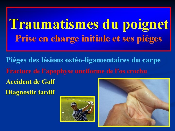 Traumatismes du poignet Prise en charge initiale et ses pièges Pièges des lésions ostéo-ligamentaires