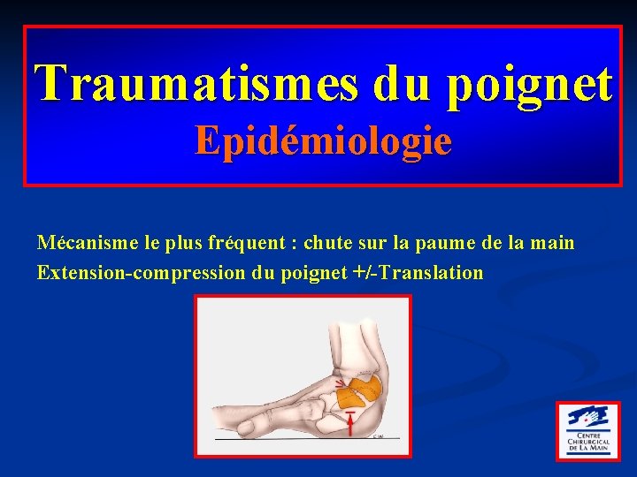 Traumatismes du poignet Epidémiologie Mécanisme le plus fréquent : chute sur la paume de