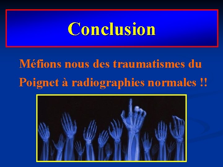 Conclusion Méfions nous des traumatismes du Poignet à radiographies normales !! 