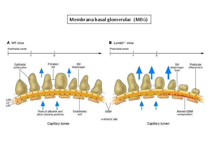 Membrana basal glomerular (MBG) 