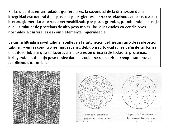 En las distintas enfermedades gomerulares, la severidad de la disrupción de la integridad estructural