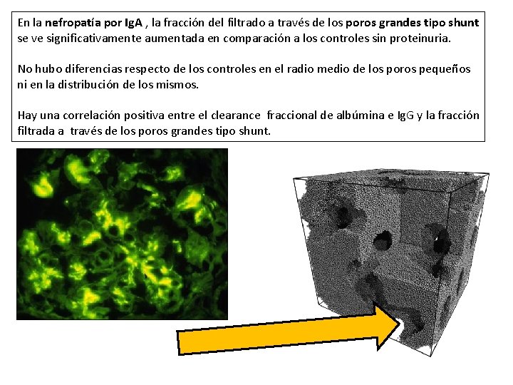 En la nefropatía por Ig. A , la fracción del filtrado a través de