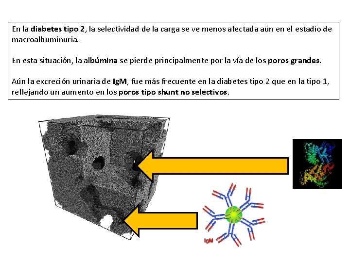 En la diabetes tipo 2, la selectividad de la carga se ve menos afectada
