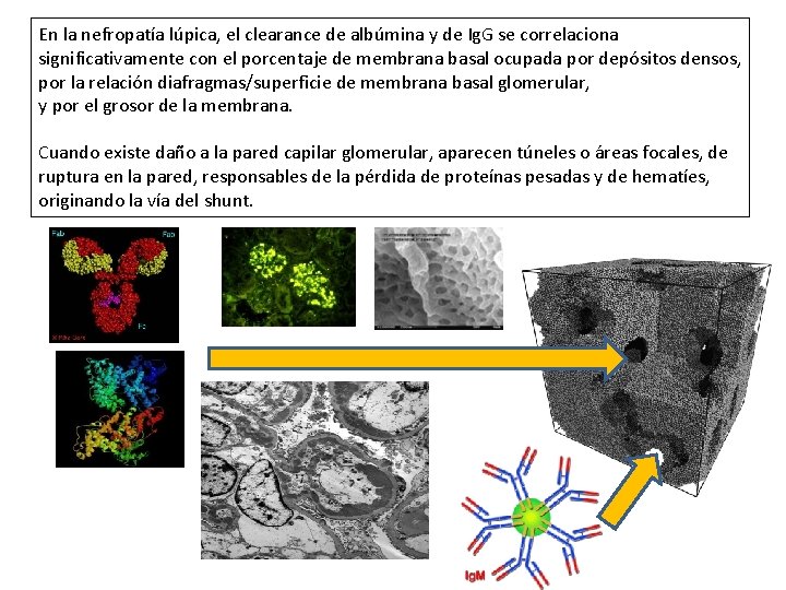 En la nefropatía lúpica, el clearance de albúmina y de Ig. G se correlaciona