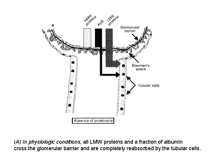 (A) In physiologic conditions, all LMW proteins and a fraction of albumin cross the