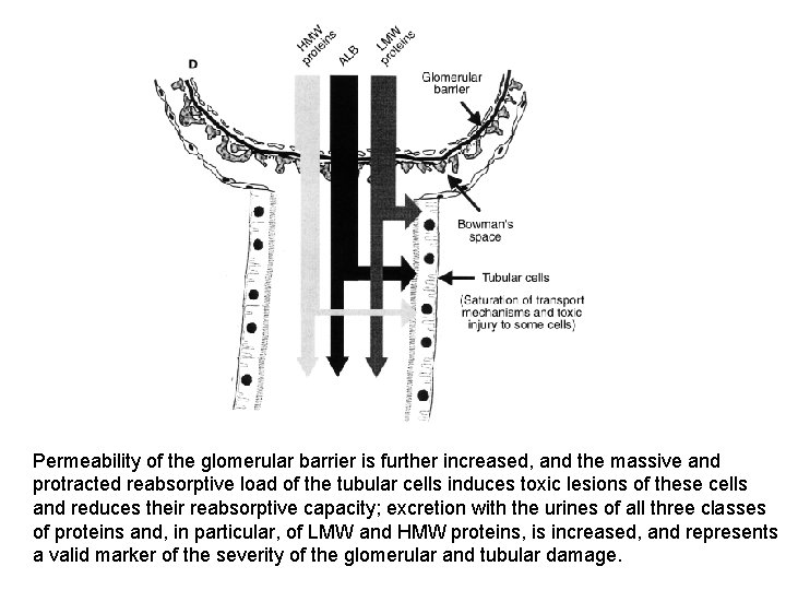 Permeability of the glomerular barrier is further increased, and the massive and protracted reabsorptive