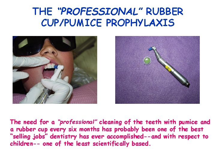THE “PROFESSIONAL” RUBBER CUP/PUMICE PROPHYLAXIS The need for a “professional” cleaning of the teeth