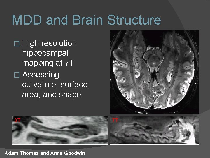 MDD and Brain Structure High resolution hippocampal mapping at 7 T � Assessing curvature, MDD and Brain Structure High resolution hippocampal mapping at 7 T � Assessing curvature,