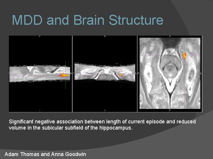 MDD and Brain Structure Significant negative association between length of current episode and reduced MDD and Brain Structure Significant negative association between length of current episode and reduced