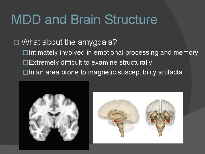 MDD and Brain Structure � What about the amygdala? �Intimately involved in emotional processing MDD and Brain Structure � What about the amygdala? �Intimately involved in emotional processing