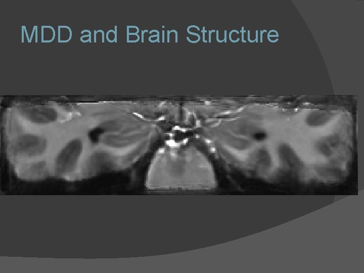MDD and Brain Structure MDD and Brain Structure