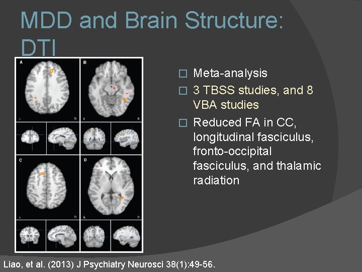 MDD and Brain Structure: DTI Meta-analysis � 3 TBSS studies, and 8 VBA studies MDD and Brain Structure: DTI Meta-analysis � 3 TBSS studies, and 8 VBA studies