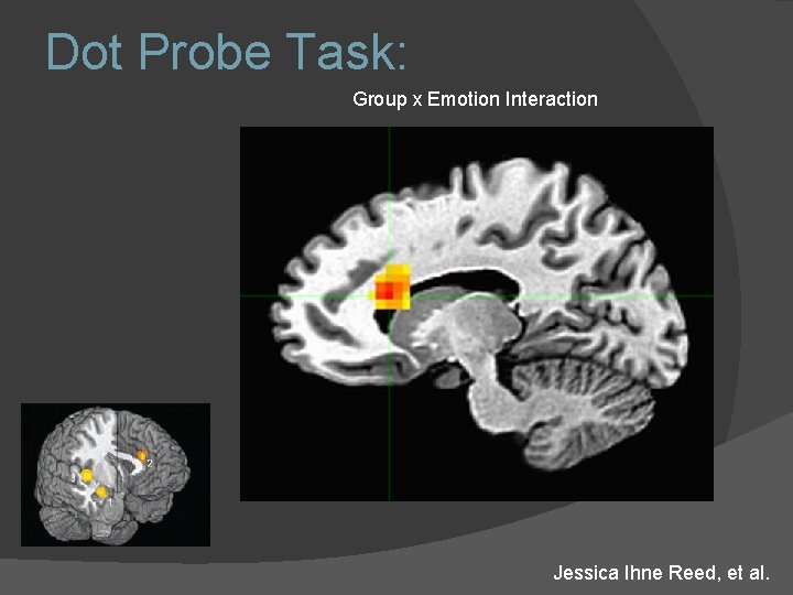 Dot Probe Task: Group x Emotion Interaction Jessica Ihne Reed, et al. Dot Probe Task: Group x Emotion Interaction Jessica Ihne Reed, et al.