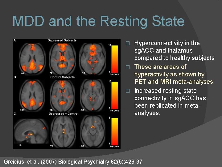 MDD and the Resting State Hyperconnectivity in the sg. ACC and thalamus compared to MDD and the Resting State Hyperconnectivity in the sg. ACC and thalamus compared to