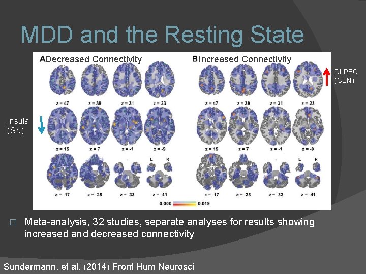 MDD and the Resting State Decreased Connectivity Increased Connectivity DLPFC (CEN) Insula (SN) � MDD and the Resting State Decreased Connectivity Increased Connectivity DLPFC (CEN) Insula (SN) �