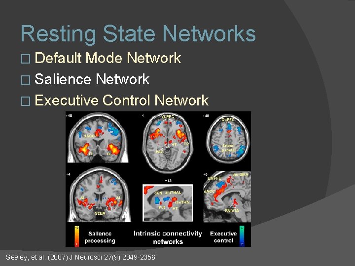 Resting State Networks � Default Mode Network � Salience Network � Executive Control Network Resting State Networks � Default Mode Network � Salience Network � Executive Control Network
