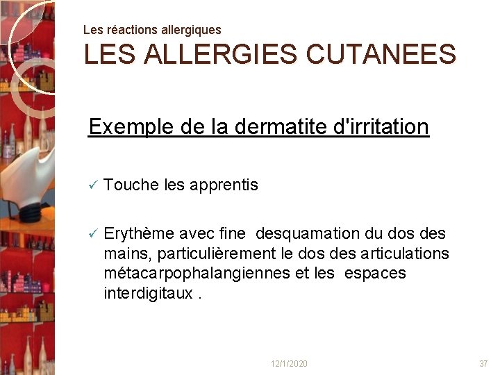 Les réactions allergiques LES ALLERGIES CUTANEES Exemple de la dermatite d'irritation ü Touche les