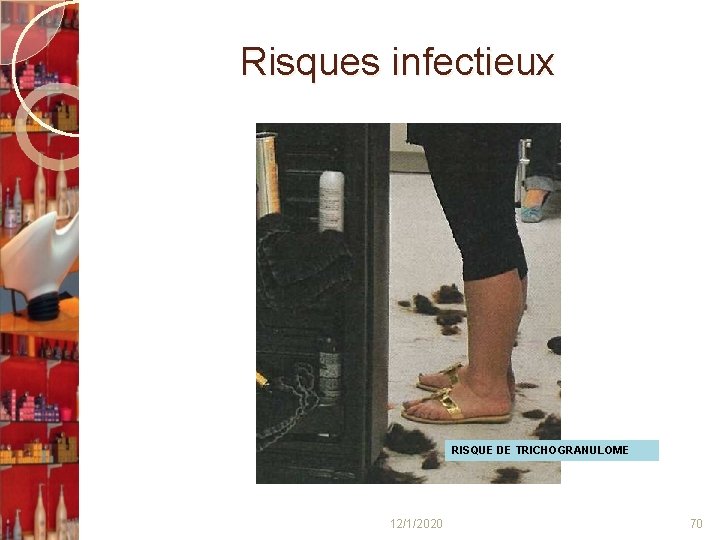 Risques infectieux RISQUE DE TRICHOGRANULOME 12/1/2020 70 