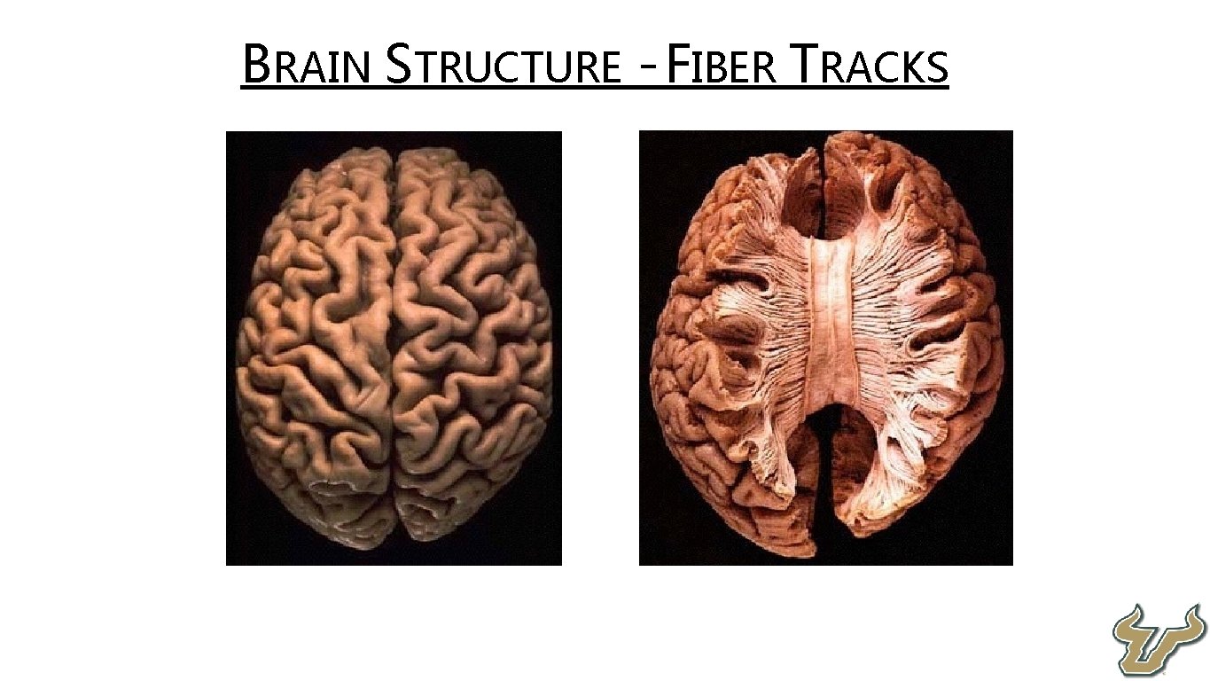  • BRAIN STRUCTURE - FIBER TRACKS 