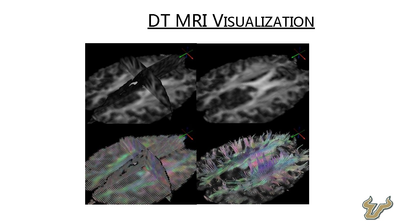  • DT MRI VISUALIZATION 