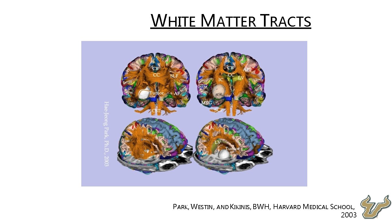  • WHITE MATTER TRACTS • PARK, WESTIN, AND KIKINIS, BWH, HARVARD MEDICAL SCHOOL,
