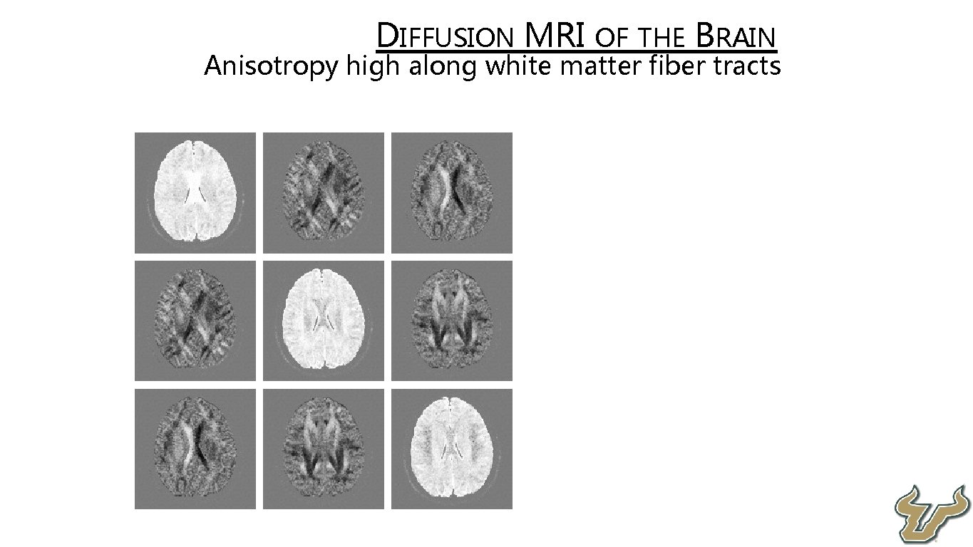  • • DIFFUSION MRI OF THE BRAIN Anisotropy high along white matter fiber
